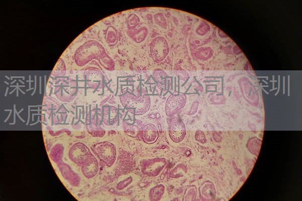 深圳深井水质检测公司，深圳水质检测机构