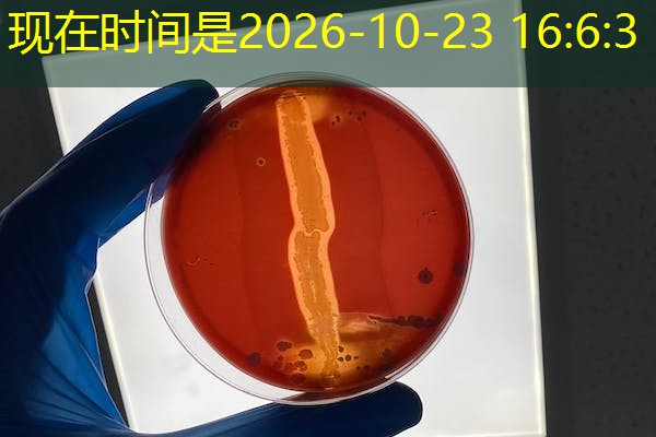 安徽防松螺母检测机构，防松螺母国标