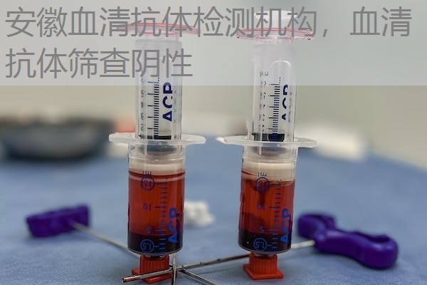 安徽血清抗体检测机构，血清抗体筛查阴性