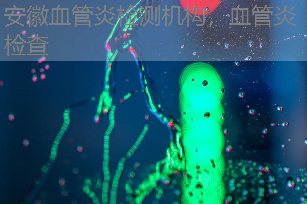 安徽血管炎检测机构,血管炎检查 安徽血管炎检测机构,血管炎检查
