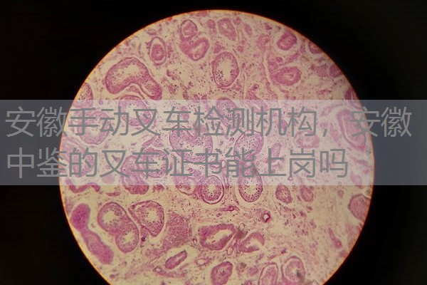 安徽手动叉车检测机构,安徽中鉴的叉车证书能上岗吗 安徽手动叉车检测机构,安徽中鉴的叉车证书能上岗吗