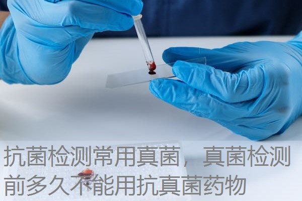 抗菌检测常用真菌，真菌检测前多久不能用抗真菌药物