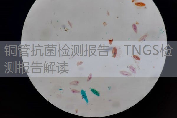 铜管抗菌检测报告，TNGS检测报告解读