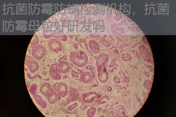 抗菌防霉防螨检测机构，抗菌防霉母粒好研发吗