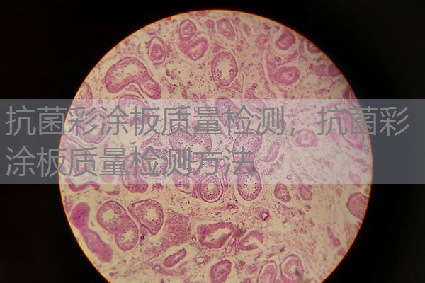 抗菌彩涂板质量检测，抗菌彩涂板质量检测方法