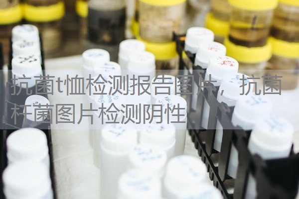 抗菌t恤检测报告图片，抗菌杆菌图片检测阴性