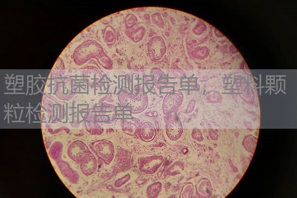 塑胶抗菌检测报告单，塑料颗粒检测报告单